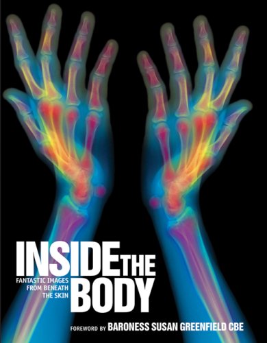 Inside the Body: Fantastic Images from Beneath the Skin Greenfield PhD  CBE, Bar Susan