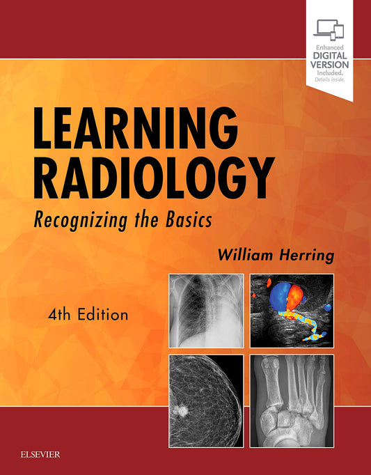 Learning Radiology: Recognizing the Basics Herring MD  FACR, William - Good