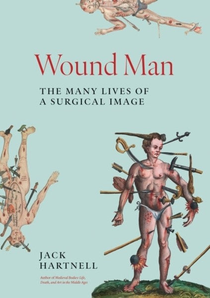 Wound Man: The Many Lives of a Surgical Image